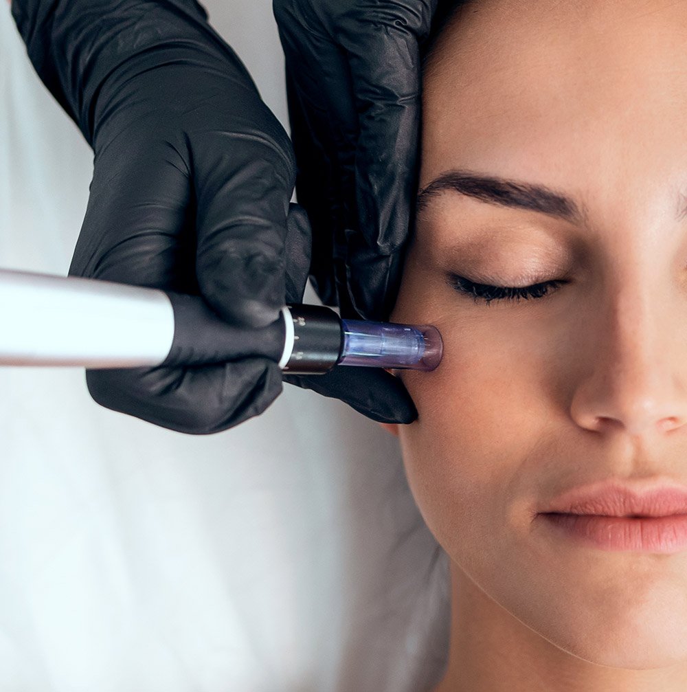 Mesoterapia